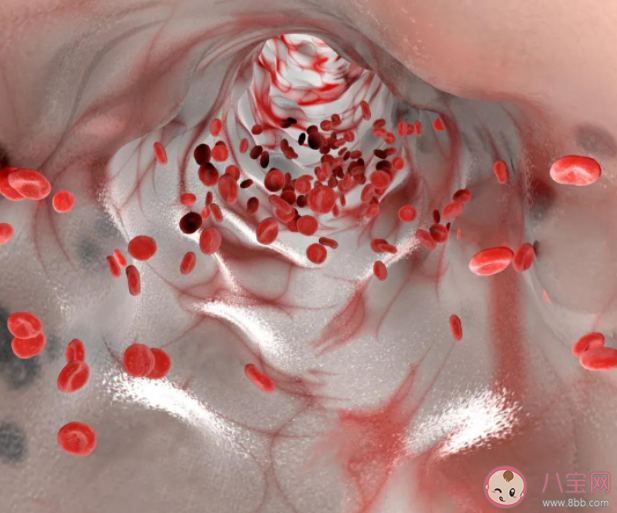 血管能不能软化 这些软化血管的说法都是假的 血管能不能软化 这些软化血管的说法都是假的