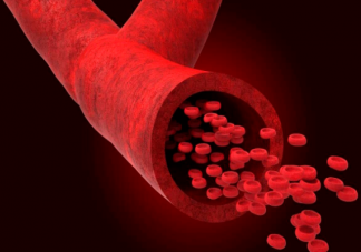 血管能不能软化 这些软化血管的说法都是假的