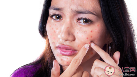 柳絮引起过敏皮肤痒去医院前可以 蚂蚁庄园4月19日答案介绍