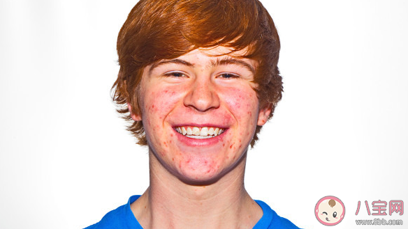 柳絮引起过敏皮肤痒去医院前可以 蚂蚁庄园4月19日答案介绍