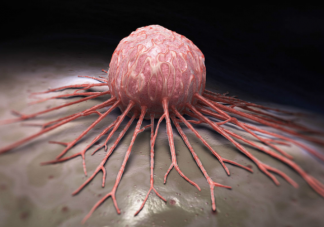 癌症会传染吗 预防癌症的几大建议