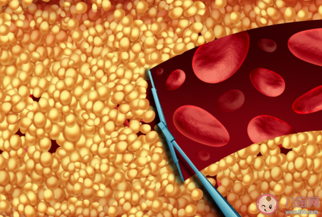 胆固醇与甘油三酯哪个升高更危险 低密度脂蛋白胆固醇的正常范围是多少 胆固醇与甘油三酯哪个升高更危险 低密度脂蛋白胆固醇的正常范围是多少