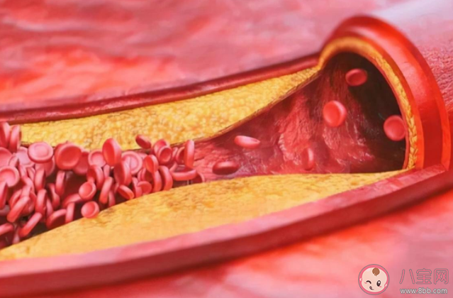胆固醇与甘油三酯哪个升高更危险 低密度脂蛋白胆固醇的正常范围是多少 胆固醇与甘油三酯哪个升高更危险 低密度脂蛋白胆固醇的正常范围是多少