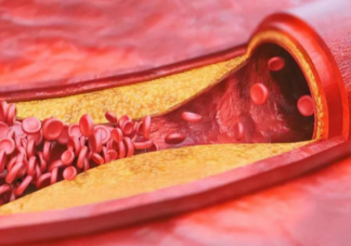 胆固醇与甘油三酯哪个升高更危险 低密度脂蛋白胆固醇的正常范围是多少