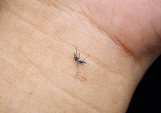 真的有招蚊体质吗 招蚊体质有什么特征