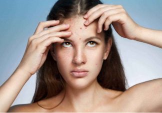 青春痘和青春有关系吗 长青春痘怎么做好得快