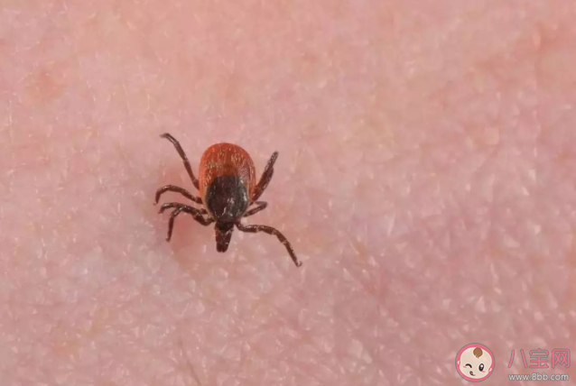 在身上发现了蜱虫该怎么处理 蜱虫叮咬预防建议