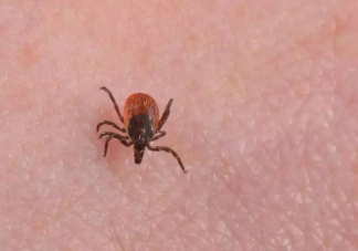 在身上发现了蜱虫该怎么处理 蜱虫叮咬预防建议