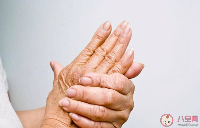 男性更容易痛风吗 痛风是终身疾病吗