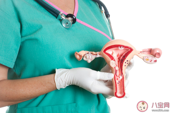 约70%卵巢癌患者确诊已是晚期 为什么卵巢癌难以发现 约70%卵巢癌患者确诊已是晚期 为什么卵巢癌难以发现