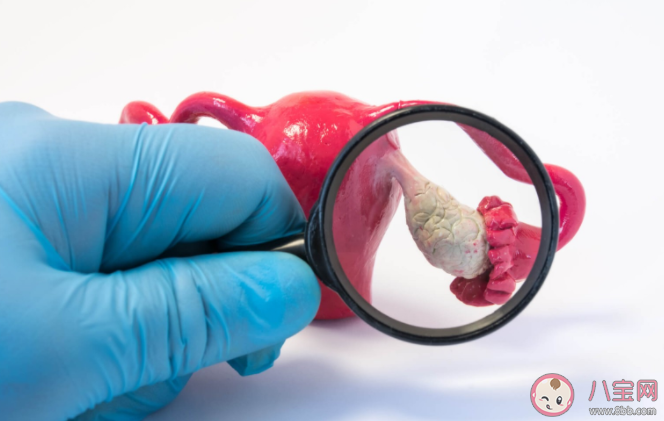 患有多囊卵巢综合征就代表不孕吗 没有生育需求多囊不用治疗吗 患有多囊卵巢综合征就代表不孕吗 没有生育需求多囊不用治疗吗