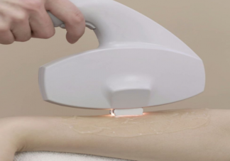 猕猴桃女孩怎么脱毛比较好 脱完毛要注意什么