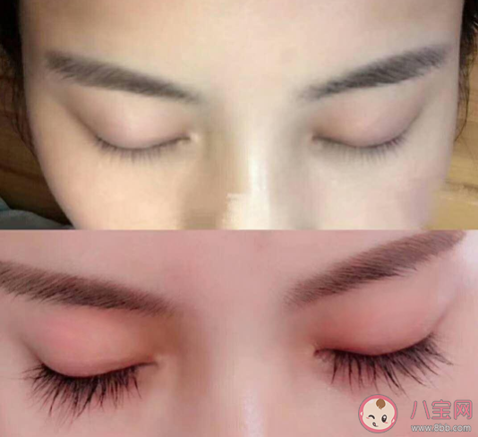 睫毛增长液真的能睫毛变长吗 睫毛增长液有副作用吗