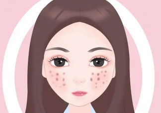 如何有效淡化脸上的痘印 脸上的痘印应该怎样去除