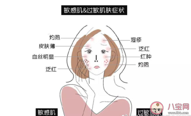 过敏和皮肤敏感如何区分 皮肤敏感和过敏有什么区别