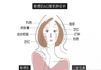 过敏和皮肤敏感如何区分 皮肤敏感和过敏有什么区别