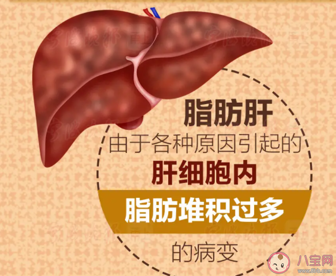 蚂蚁庄园5月25日答案：体检查出脂肪肝还能继续吃肉吗