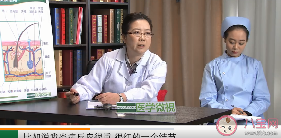 面部危险三角区的痘痘为什么不能挤 粉刺和痘痘到底能不能挤