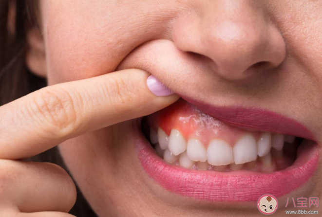 如果牙齿上出现小白点我们应该怎样 蚂蚁庄园5月26日答案 如果牙齿上出现小白点我们应该怎样 蚂蚁庄园5月26日答案