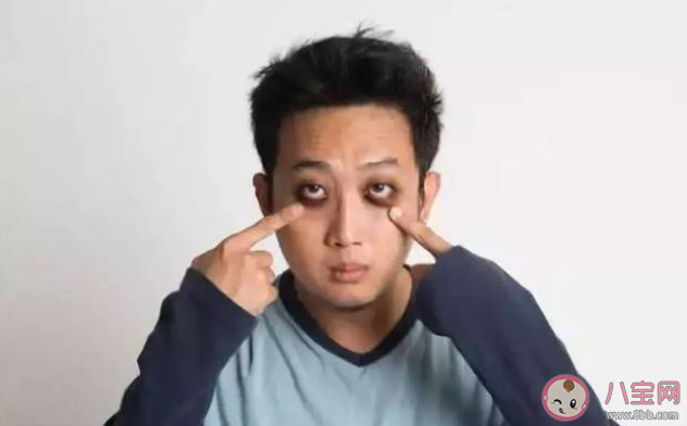 为什么不熬夜也会有黑眼圈 该如何消除黑眼圈