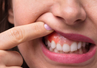 如果牙齿上出现小白点我们应该怎样 蚂蚁庄园5月26日答案