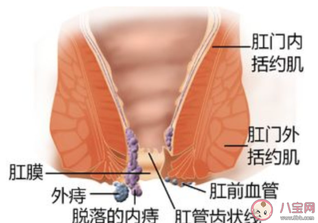 为什么早期肠癌往往被误诊为痔疮 早期肠癌和痔疮有什么区别