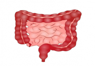 为什么直肠癌容易误诊 直肠癌会有哪些症状表现