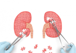 泌尿系统结石有哪些典型症状 如何治疗泌尿系统结石