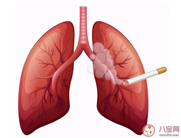 为什么不抽烟也可能得肺癌 肺癌如何预防