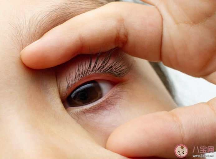 为什么早晨刚醒时很容易眼干 如何给眼睛补水