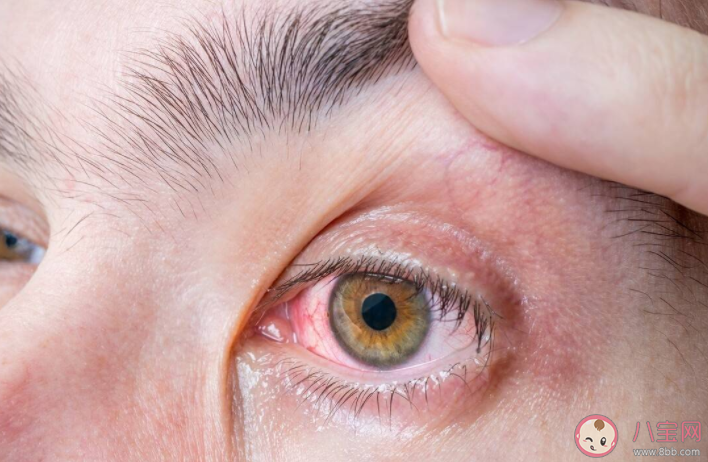 2022全国爱眼日主题是什么 眼睛遇到外伤怎么办