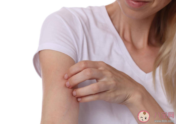 长湿疹是不是要少洗澡 得了湿疹生活中应该注意什么