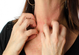 长湿疹是不是要少洗澡 得了湿疹生活中应该注意什么