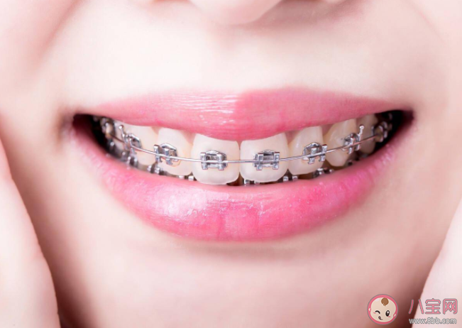 成年人矫正牙齿更容易反弹吗 矫正牙齿有年龄限制吗