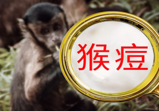 猴痘病毒可通过飞沫传播吗 猴痘病毒来源是什么