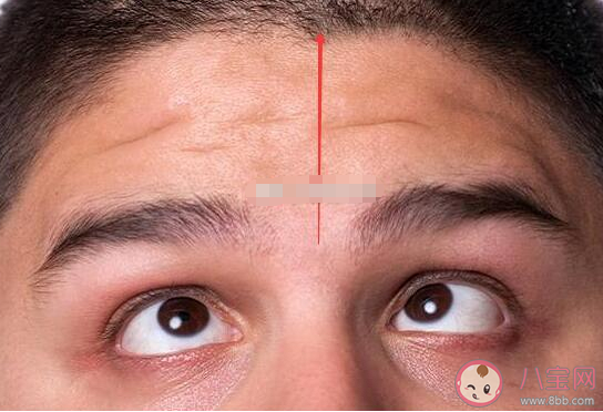 印堂发黑是迷信还是科学 怎么观察面相发现健康问题