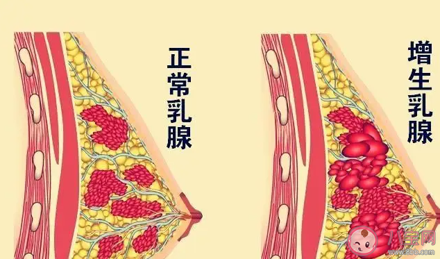 哪些行为会增加患乳腺结节的风险 患乳腺结节后会有哪些症状