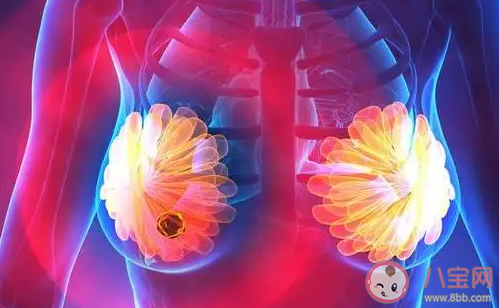 哪些行为会增加患乳腺结节的风险 患乳腺结节后会有哪些症状