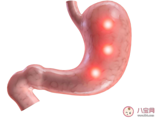 胃癌容易缠上哪种血型的人 为什么A型血容易得胃癌