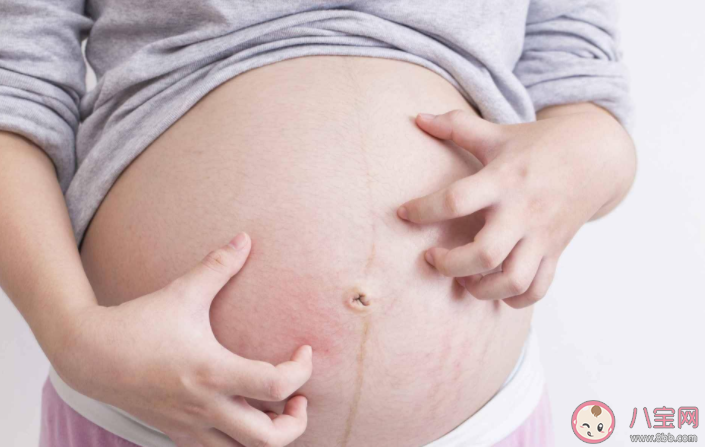 妊娠糖尿病和胖瘦有关系吗 孕期血糖高怎样控制