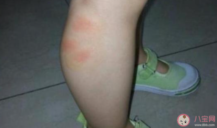 孕妇和宝宝更容易招蚊子真是这样吗 蚂蚁庄园7月6日答案最新 孕妇和宝宝更容易招蚊子真是这样吗 蚂蚁庄园7月6日答案最新