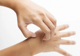 汗疱疹可以掐破吗 汗疱疹和什么方面有关