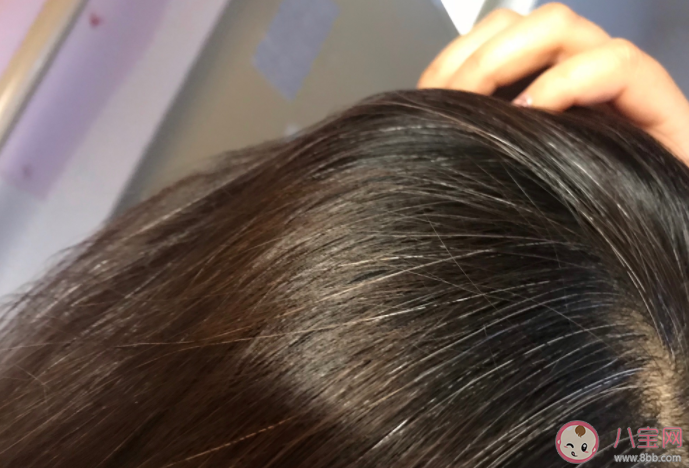 白发突然增多是缺什么营养 白发越来越多怎么办