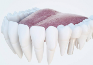 根管治疗有多复杂 根管治疗要花多少钱