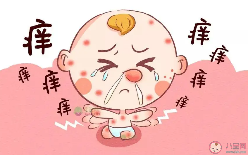 如何帮孩子预防过敏 孩子过敏了怎么办