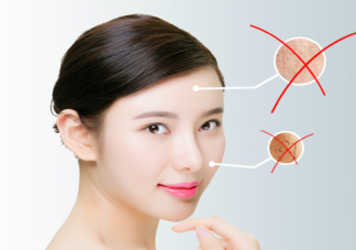 长期熬夜可加重皮肤过敏吗 皮肤过敏和情绪有关吗