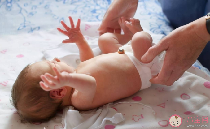 新生儿脐炎是怎么回事 新生儿脐炎的怎么办