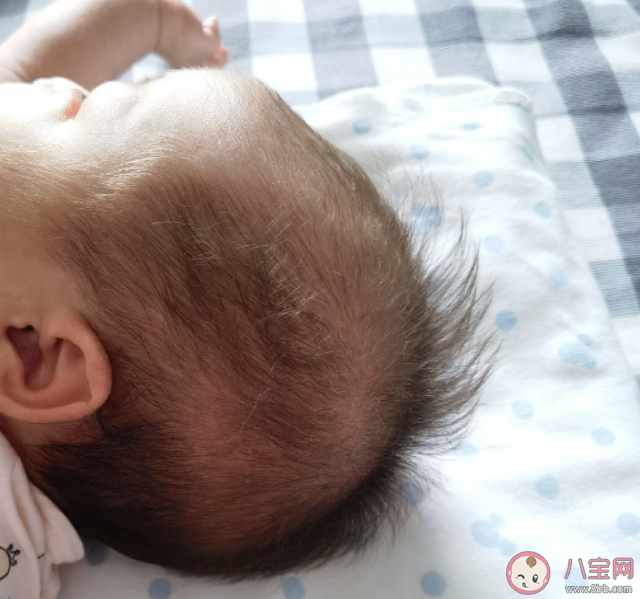 新生儿头发浓密稀疏是由什么决定 新生儿头发少该怎么办