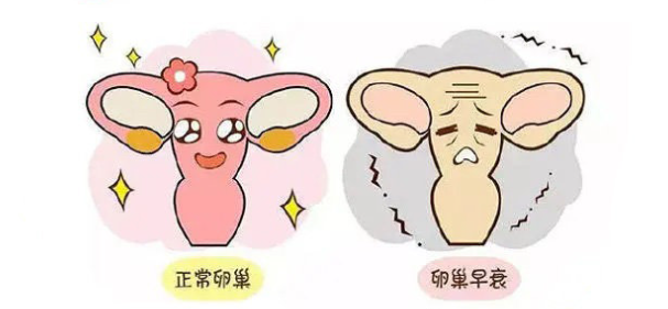 卵巢早衰的征兆有哪些 如何防止卵巢早衰