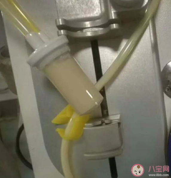 牛奶血是什么意思 牛奶血为什么不能给病人输用